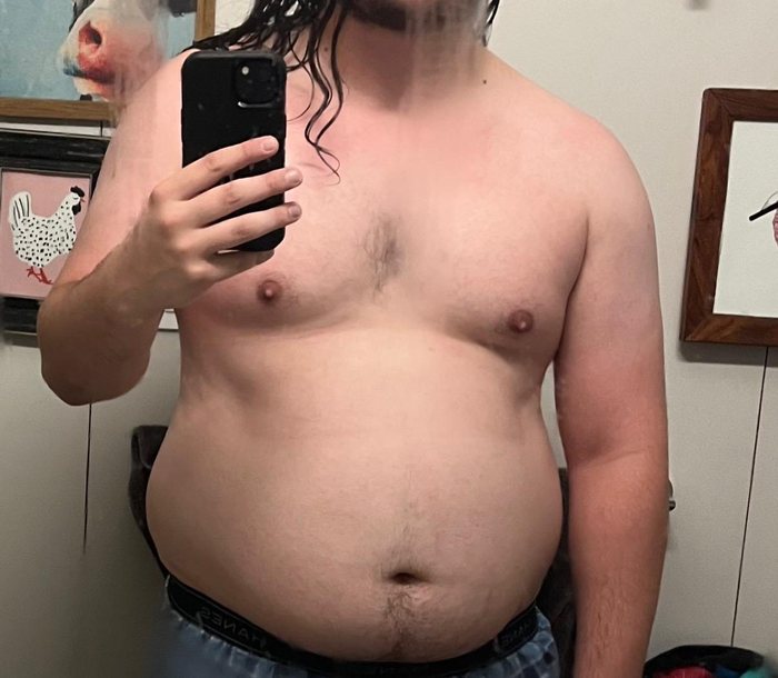 Before — Case M-06